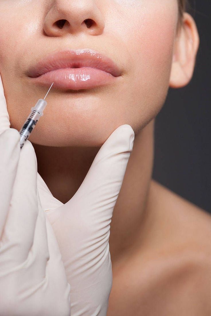 Preenchimento facial